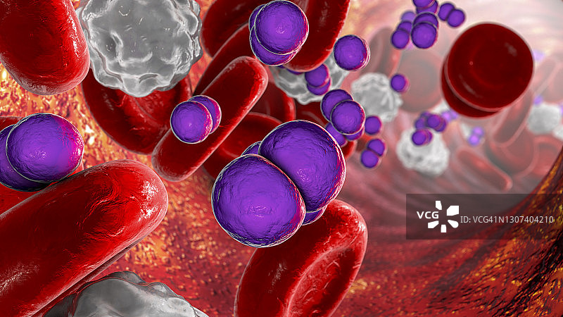 脑膜炎球菌血症插图图片素材