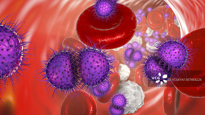 脑膜炎球菌血症插图图片素材