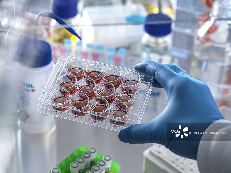 科学家在通风橱中手持带有血液样本的多孔板图片素材