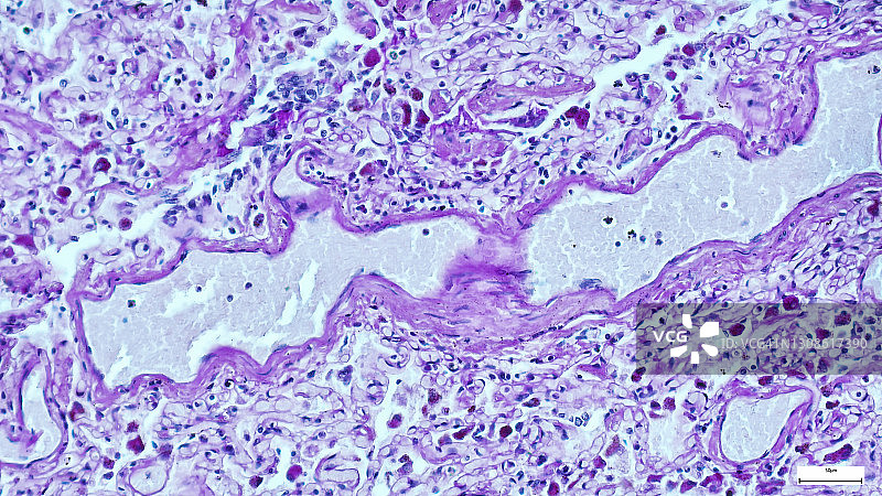 组织切片的显微镜照片，组织病理学检查图片素材