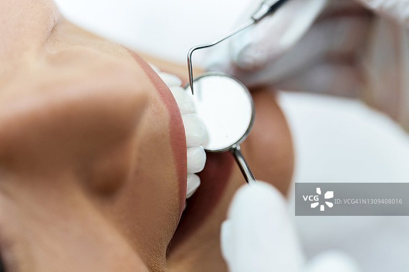 牙医检查牙齿特写图片素材