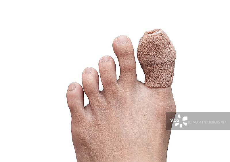 女人右脚大脚趾受伤特写，白色背景隔离，事故与健康护理概念图片素材