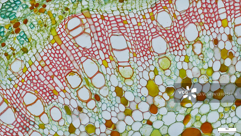 蕨科植物。免疫荧光显微照片，器官样本，组织学检查，显微镜下的组织病理学图片素材