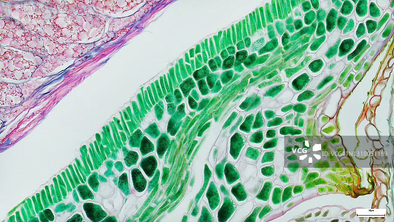 发育中的小梁骨的组织学评估。Goldner氏三色染色，蓝/绿色代表矿化组织。免疫荧光显微照片，器官样本。图片素材