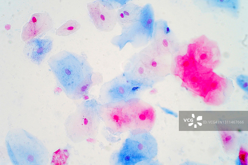 鳞状上皮细胞，光学显微照片图片素材