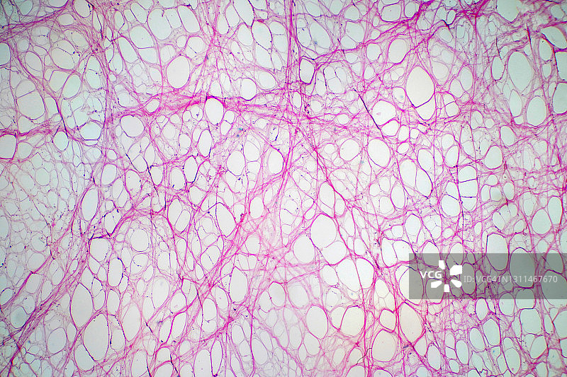 疏松结缔组织显微照片图片素材