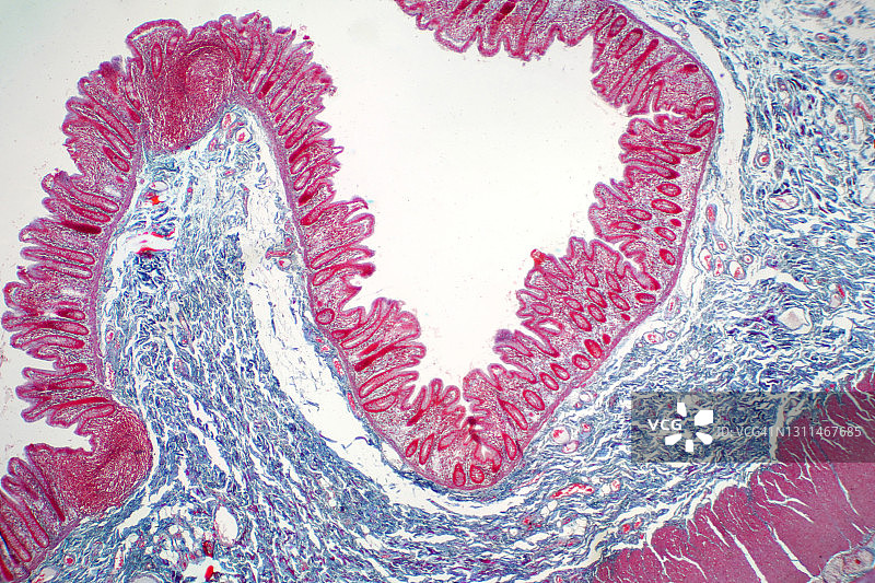 人类大肠显微照片图片素材