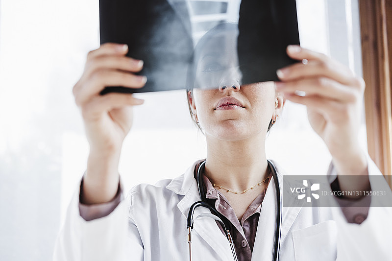 女医务人员在窗边检查X光片图片素材