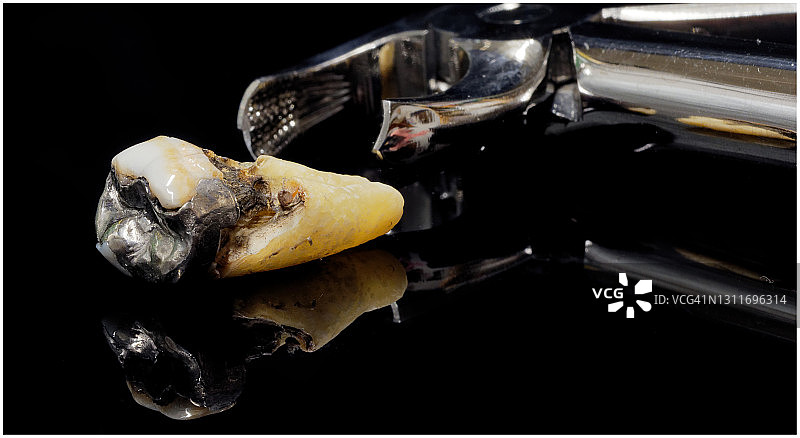 坏牙齿（黑色）图片素材