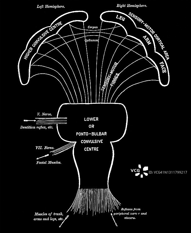 人脑古版画，示意性地显示了两个惊厥中心——皮质中心和脑桥延髓中心及其关系和连接图片素材