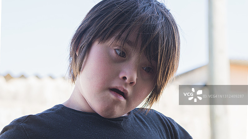 唐氏综合征儿童肖像图片素材