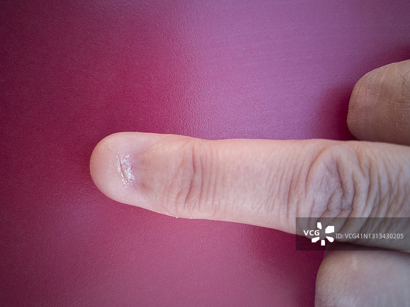 手上的无指甲手指图片素材