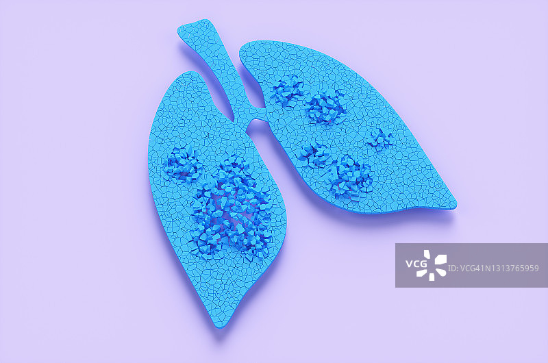紫色背景上因冠状病毒感染而出现孔洞的蓝色人类肺部3D渲染图图片素材
