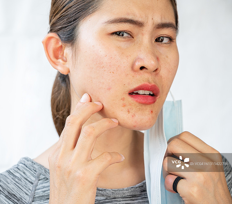 疫情期间长时间戴口罩后担心长痘的亚洲女性头像照图片素材
