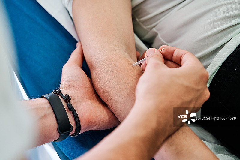 接受干针治疗手臂损伤的理疗患者模糊人像图片素材