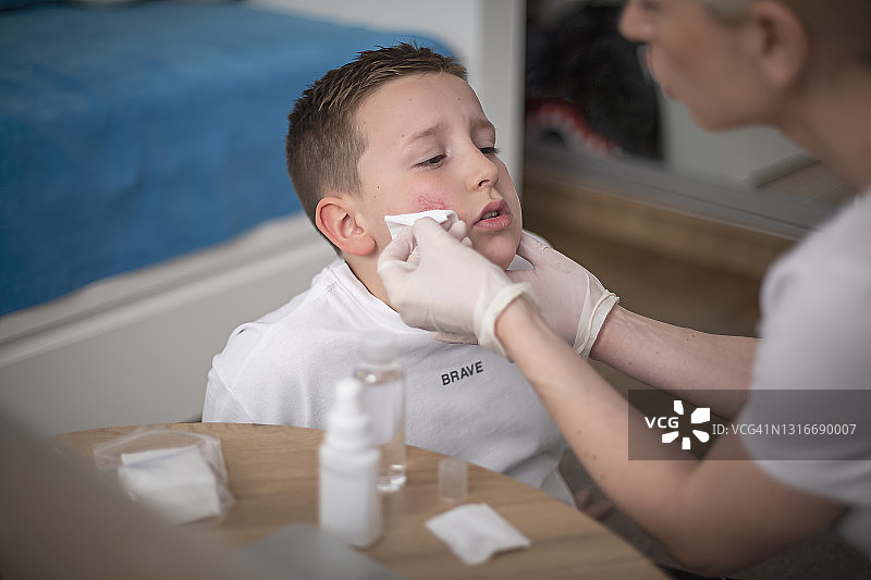 母亲清理儿子脸上的伤口图片素材