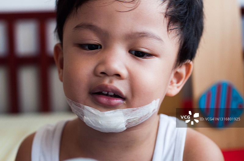东南亚男童在家中发生小事故后接受急救治疗图片素材