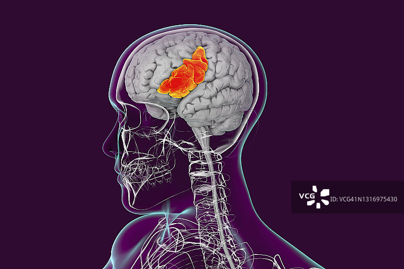 突出显示的大脑额下回插画图片素材