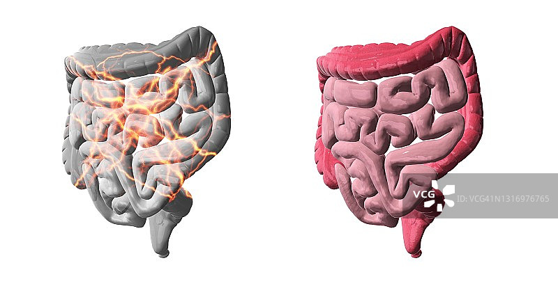健康与不健康的肠道概念图图片素材