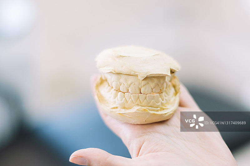患者手上的牙齿模型图片素材