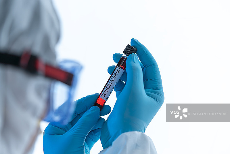 新冠病毒COVID-19感染血液样本科研图图片素材
