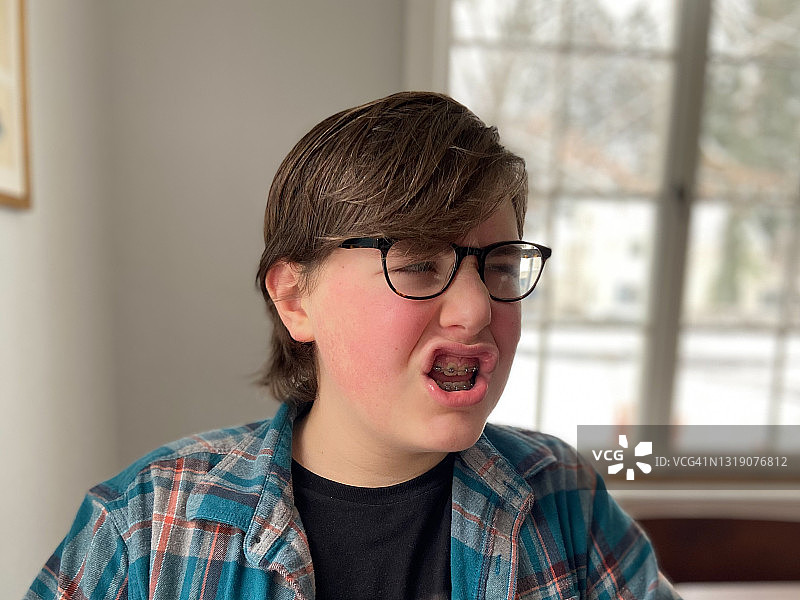 戴着牙套的男孩图片素材