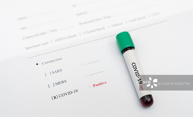 新型冠状病毒阳性血液检测结果。科学家医生身穿生化防护服，手持装有新型冠状病毒感染血液样本的试管。图片素材