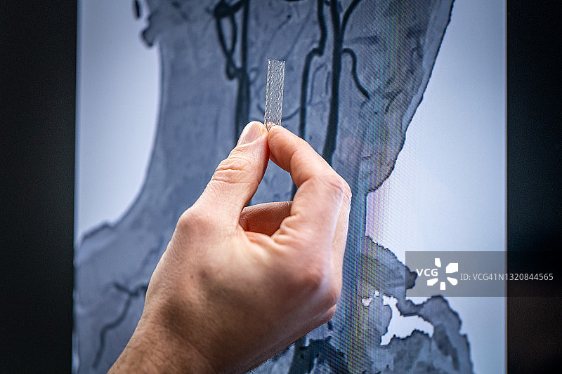 手持金属丝网支架，用于治疗血管图片素材