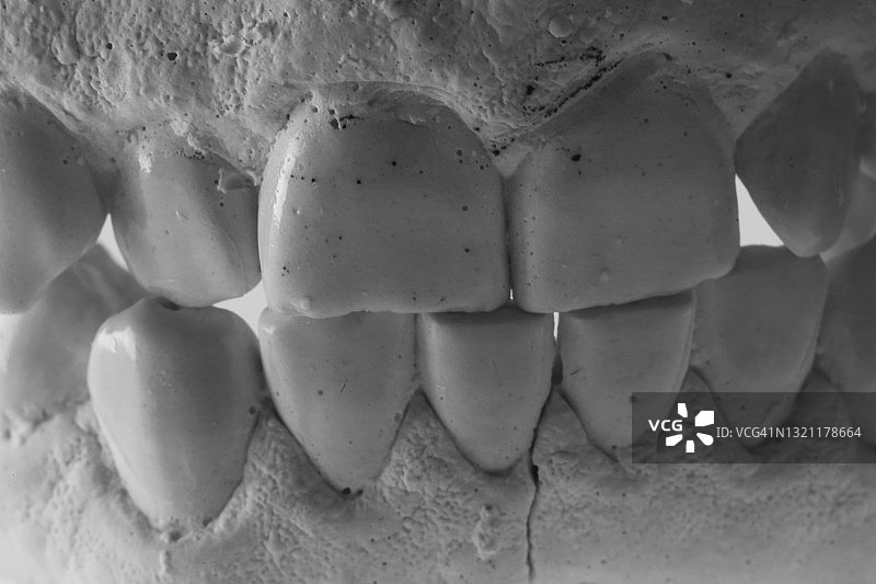 人类牙齿的牙科石膏模型图片素材