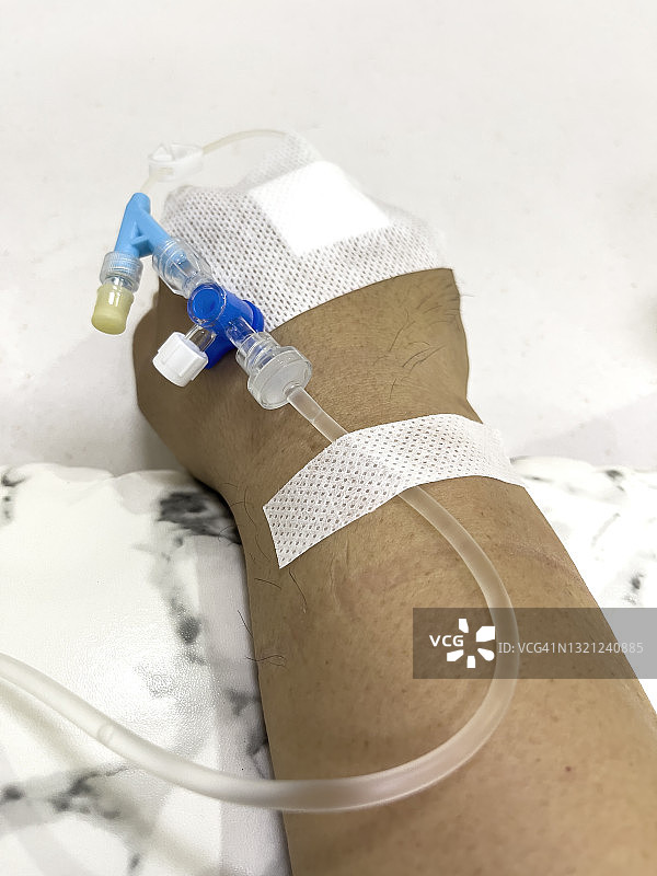 静脉输液治疗图片素材