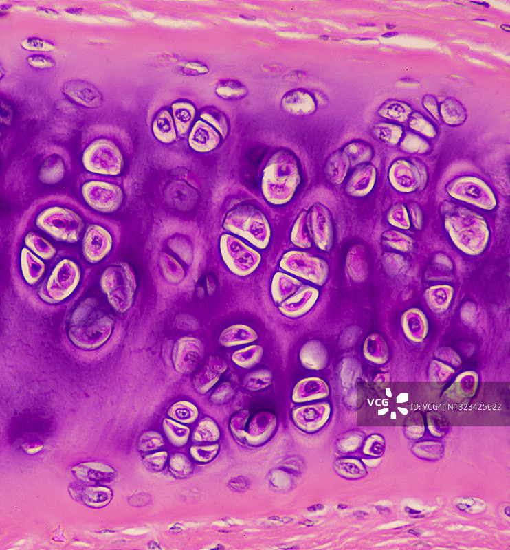 透明软骨——软骨细胞、软骨陷窝、基质、软骨膜，200倍图片素材