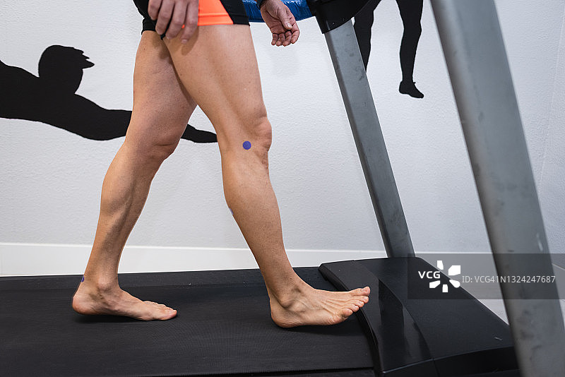 足病医生检查病人在电动跑步机上行走的足迹图片素材