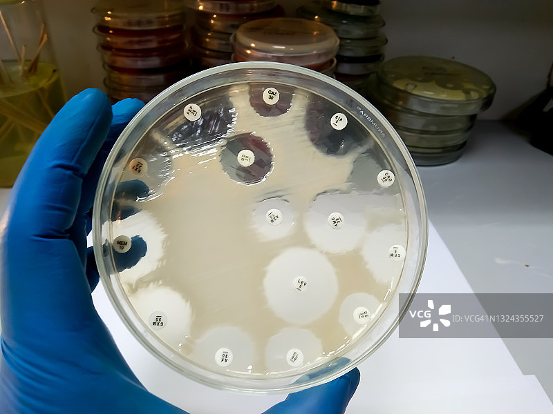 在微生物实验室的培养皿中，针对肺炎克雷伯菌（K. pneumoniae）细菌的抗菌药物敏感性测试。图片素材