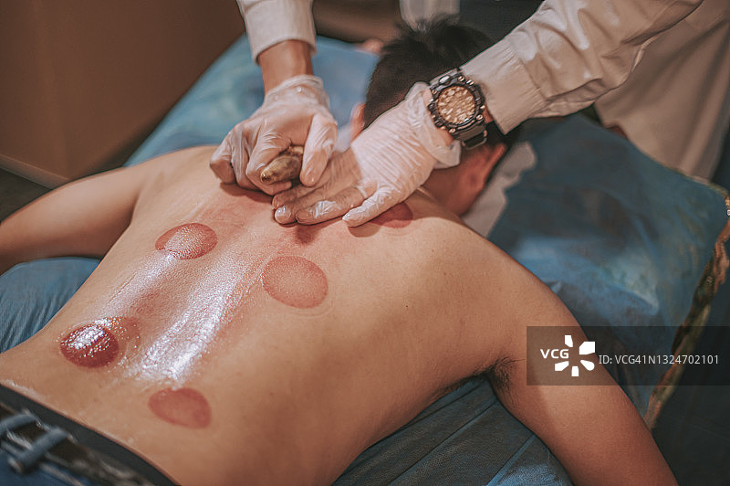 亚洲男病人在中医馆接受刮痧治疗图片素材