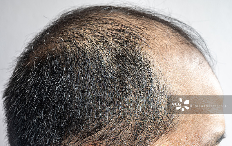 亚洲男人头部特写（少量灰发）图片素材