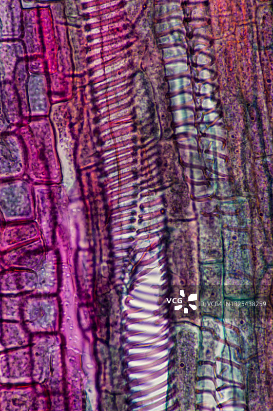 木质部导管分子，显示细胞壁中的螺旋图案，导管分子在植物的水分运输中发挥作用，100倍图片素材