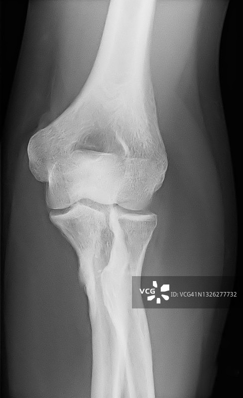 X光图像图片素材
