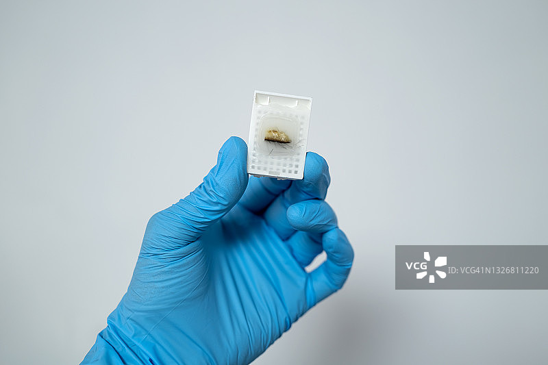 医生手持皮肤样本图片素材