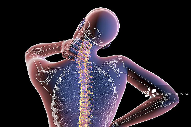 颈椎疼痛插画图片素材