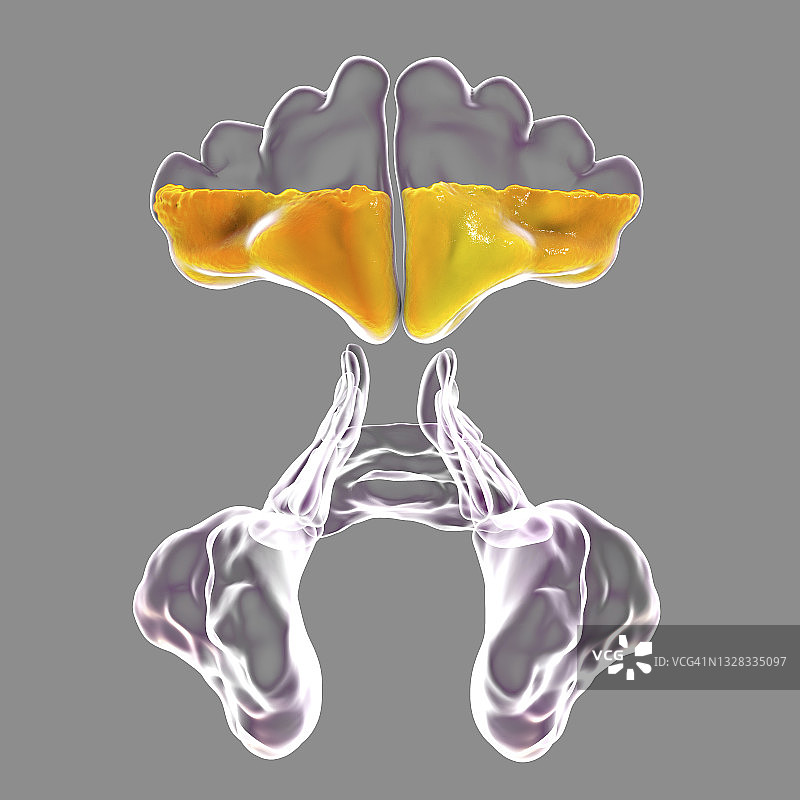鼻窦炎插图图片素材