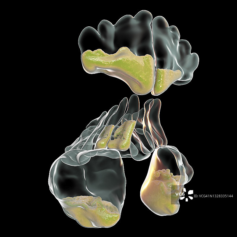 鼻窦炎插图图片素材