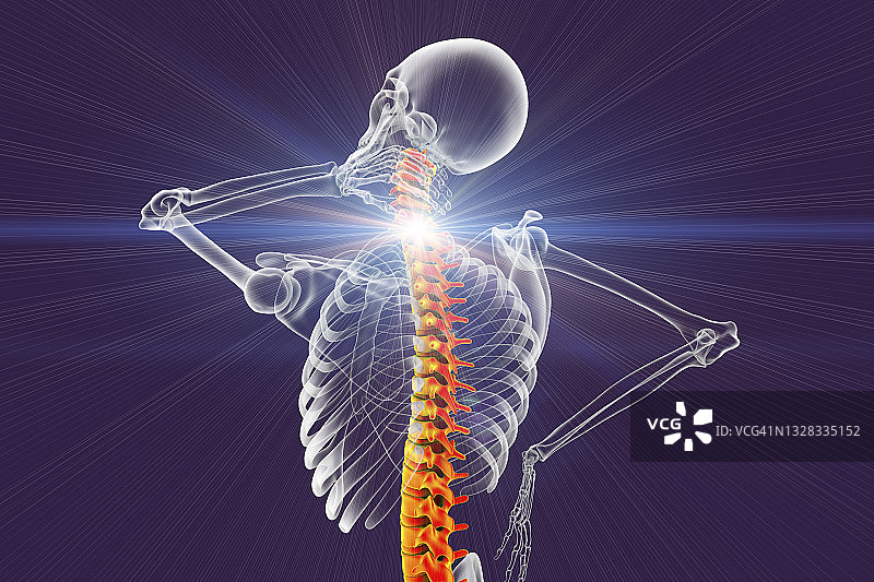 颈椎疼痛插画图片素材