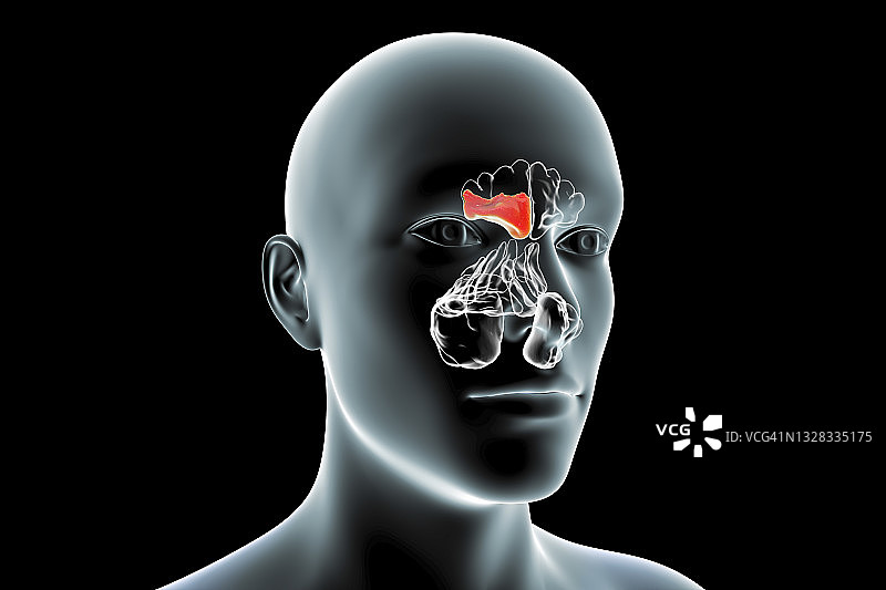 鼻窦炎插图图片素材