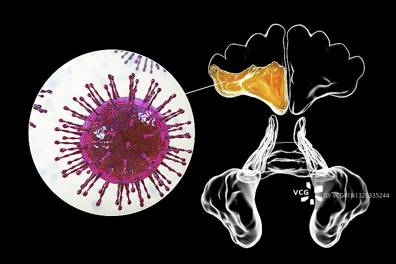 鼻窦炎插图图片素材