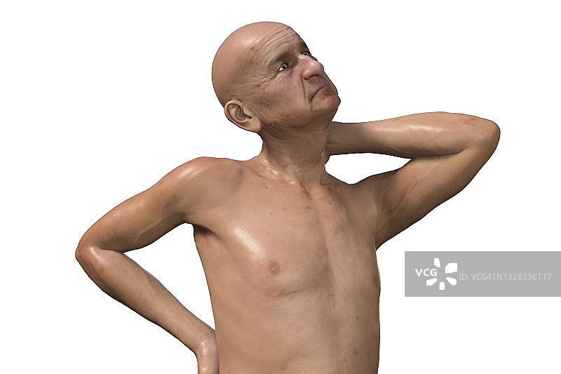 颈椎疼痛插画图片素材