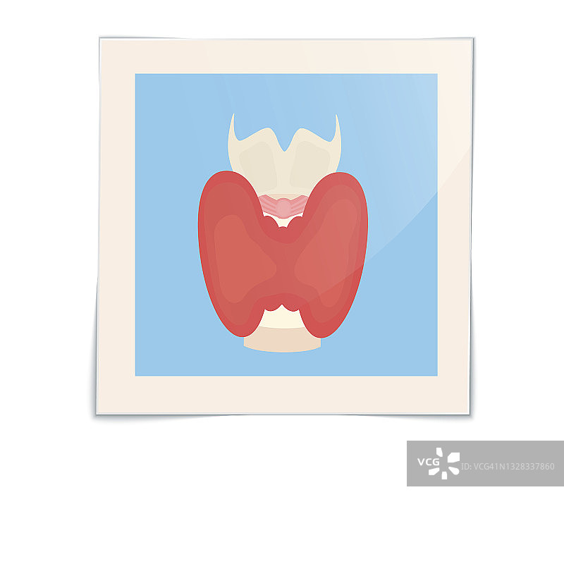 甲状腺、插图图片素材
