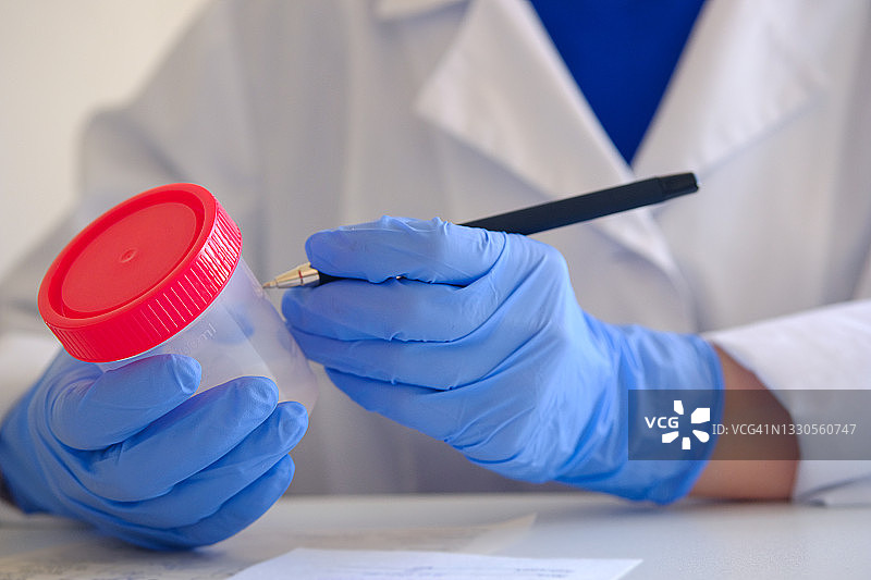 盛有精子分析样本的容器，医生填写人工授精相关文件图片素材