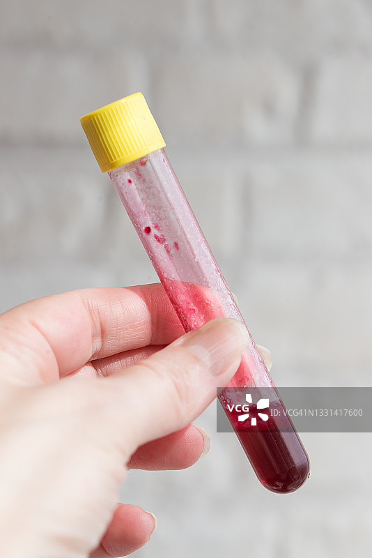 手持装有血液样本的试管图片素材