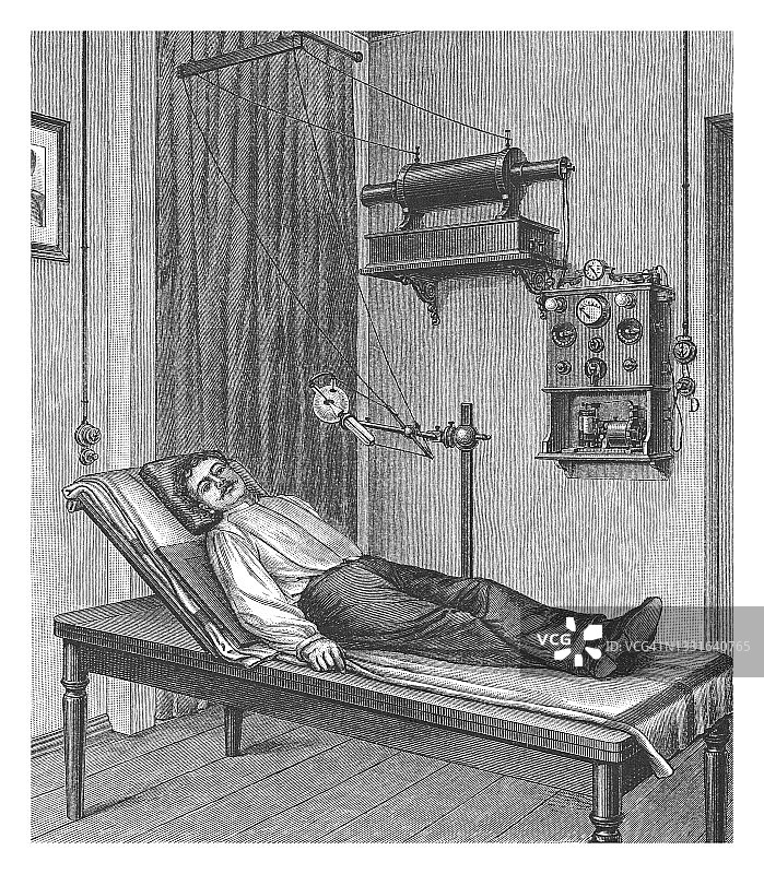 老式雕刻插图：早期伦琴X射线设备图片素材