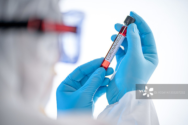 新冠病毒：医生、护士、科学家穿着防护服戴着口罩，手持受污染的患者血液样本试管， SARS-Cov-2病毒检测呈阳性图片素材